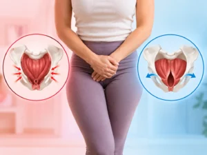 Pelvic Floor Tension and Weakness Comparison